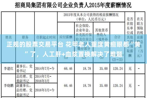 正规的股票交易平台 花甲老人重度黄疸眼都“黄”了，人工肝+血浆置换解决了难题